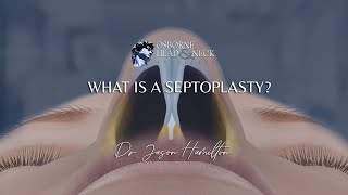 How To Survive A Septoplasty  What I Wish I Knew [upl. by Hitoshi934]