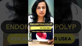 What is an Endometrial Polyp amp hows it treated  Endometrial Polyp in Hindi  Dr Nymphea Walecha [upl. by Enirehtakyram937]