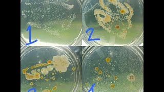 Bacteria Growth Results On Petri Dishes Science amp Homeschooling [upl. by Sofie]