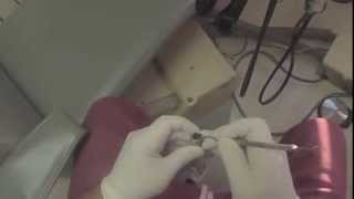 Simple way to replace the dental HVE O ring [upl. by Seligman]