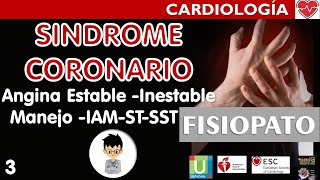 ANGINA ESTABLE INESTABLE MANEJO del IAM con y sin ELEVACIÓN ST Complicaciones Síndrome Coronario3 [upl. by Enaled254]