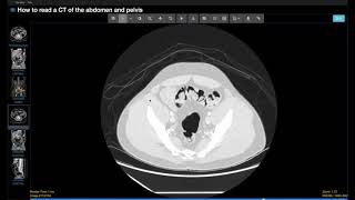 How to use a basic PACS viewer  what every medical student and resident should know [upl. by Fillender278]