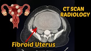 What to expect during a CT Scan [upl. by Borchert]