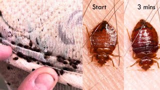 BED BUG BITES SYMPTOMS TREATMENT PREVENTION [upl. by Atinit]