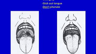 Preoperative Evaluation  Dr Hessel [upl. by Jillie85]