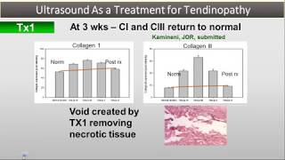 Webinar Series Deep Tissue Applications with the new TX2 MicroTip  Tony Joseph MD [upl. by Orabla904]