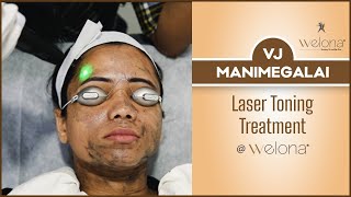 VJ Manimegalai Sharing her experience of Laser Toning Treatment At Welona Skin Lightening Treatment [upl. by Meehar189]