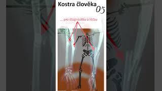 28 Kostra člověka05 anatomie biologie maturita [upl. by Navonod570]