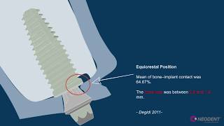 Crestal vs Subcrestal position Neodent [upl. by Whale]