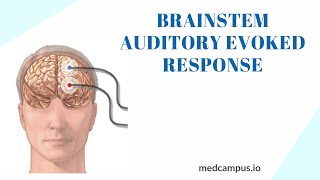 BAER Brainstem Auditory Evoked Response Test [upl. by Eido]