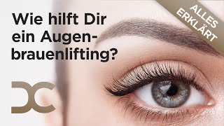 Augenbrauenlifting  Alles was du wissen solltest  Dorow Clinic [upl. by Tamaru]