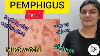 SKIN LESIONS PEMPHIGUS PART1 [upl. by Christie]