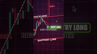 Simple trade shoulder pattern trading [upl. by Aisercal597]