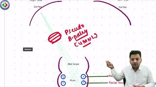 Unveiling the Differences BULBAR Palsy vs PSEUDOBULBAR Palsy [upl. by Joice854]