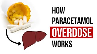 How Paracetamol Overdose Works [upl. by Natloz]