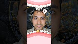 Rotten tooth extraction dentist game Derdo00 toothless dentist teeth rottenteeth game [upl. by Malvina]