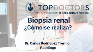 Biopsia renal ¿Cómo se realiza [upl. by Nnylyma154]