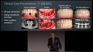 An introduction to the Trefoil system by Dr Kenji Higuchi [upl. by Ynned]