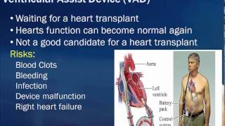 Coronary Heart Disease  Critical Care [upl. by Eilata]