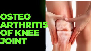 TOPICquot29OSTEOARTHRITIS OF KNEE JOINTSIGN SYMPTOMS AND TREATMENT [upl. by Ellah]