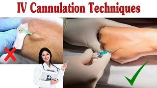 How To Insert IV Cannula  IV Cannulation Techniques [upl. by Ymmot]