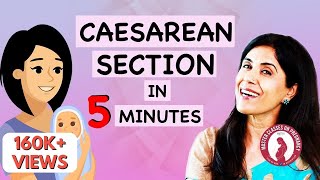 Caesarean Section In 5 Minutes  Maitri  Dr Anjali Kumar [upl. by Norrek]