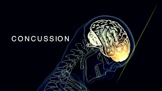 Concussion In Sport  Sport Medicine Physical Education PE [upl. by Evoy979]