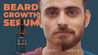 Satthwa Beard Growth Serum With Redensyl™  How to Apply  Beard Growth Before amp After [upl. by Landmeier771]