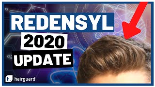 Redensyl 2020 Updates For YOUR Hair GROWTH [upl. by Lefton]