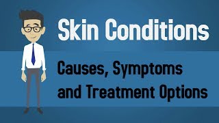 Skin Conditions  Causes Symptoms and Treatment Options [upl. by Najib64]