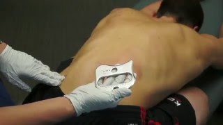 IASTM Anchoring Technique  Instrument Assisted Soft Tissue Mobilization [upl. by Cumings]