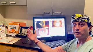 Do Intacs Work for Keratoconus [upl. by Medrek]