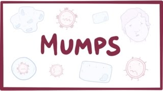 Mumps  symptoms diagnosis treatment pathology [upl. by Grimaud]