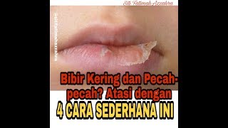 4 CARA MENGATASI BIBIR KERING amp PECAHPECAH [upl. by Alael]