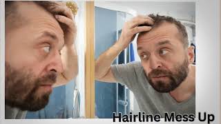 Messed Up Hairline How To Fix A Messed Up Hairline [upl. by Laraine]