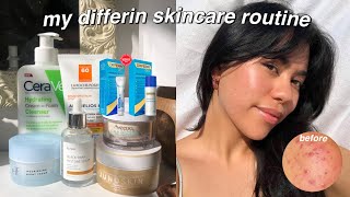 MY Differin Gel Skincare Routine [upl. by Abeh592]