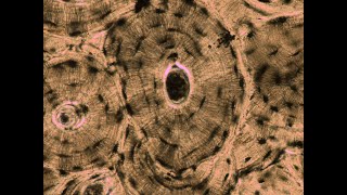 Lab 15  Structures of Compact Bone Microscope [upl. by Naibaf]