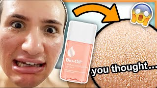 I tried BIO OIL on my face for ONE WEEK my mom really thought this was a miracle oil lol [upl. by Ytsrik228]