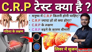 INFLAMMATORY BOWEL DISEASE Hindi  CROHNS DISEASE  ULCERATIVE COLITIS  NURSES TECH ONLINE [upl. by Eikciv]