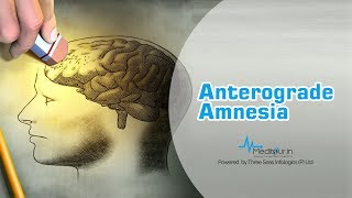 Anterograde amnesia [upl. by Columbine]