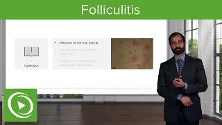 Infectious Skin Diseases Folliculitis – Pathology  Lecturio [upl. by Augustin303]