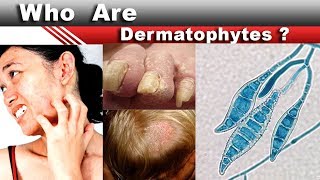 Who are dermatophytes [upl. by Prober]