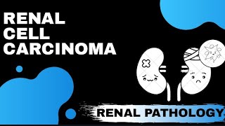 Renal cell carcinoma  Renal pathology  Med Bees [upl. by Bethany]