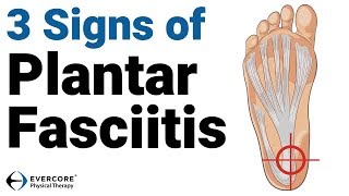 Plantar Fasciitis 3 signs you may have plantar fasciitis [upl. by Light955]