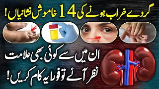 14 Silent Symptoms Of Kidney Failure  Kidney Disease Signs Causes And Symptoms Urdu Hindi [upl. by Tubb]