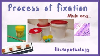 What is Fixation  Tissue Fixation in Histology  Hindi  Histopathology [upl. by Anaiviv]