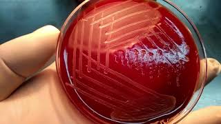 Colony morphology of bacteria  beta haemolytic streptococci  S pyogenes S agalactiae [upl. by Yhtomot]