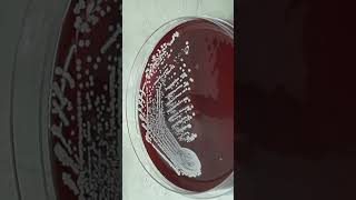 Growth Character of Staphylococcus hominis on Blood Agar Colony Morphology and Diagnostic Insights [upl. by Attenhoj]