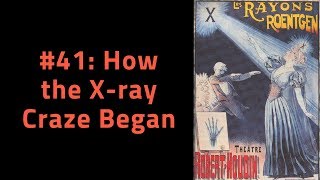 How the shy Roentgen created the Xray Craze [upl. by Monda]