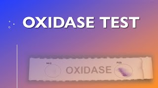 Oxidase Test [upl. by Haswell228]